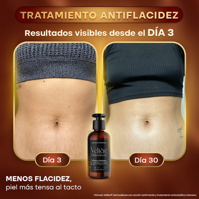 Dermodeluxe Alta Cosmética: Tratamiento para Celulitis, Flacidez, Arrugas y Reafirmante - 250 ML.