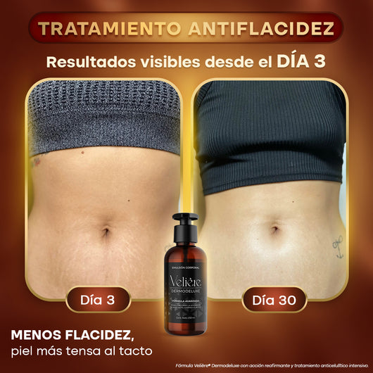 Dermodeluxe Alta Cosmética: Tratamiento para Celulitis, Flacidez, Arrugas y Reafirmante - 250 ML.