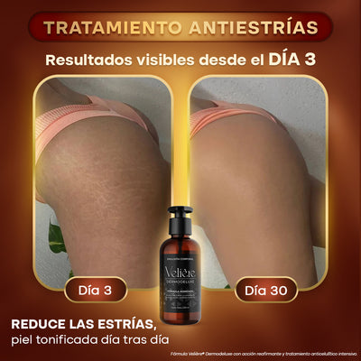 Dermodeluxe Alta Cosmética: Tratamiento para Celulitis, Flacidez, Arrugas y Reafirmante - 250 ML.