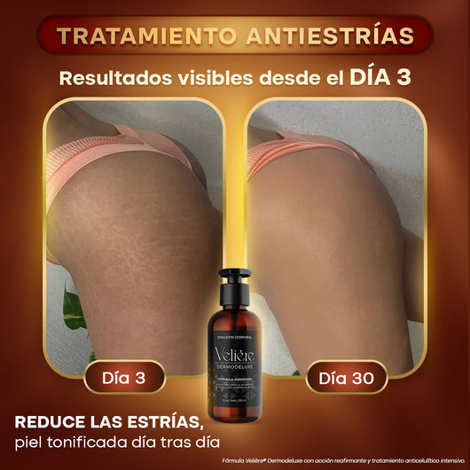 Dermodeluxe Alta Cosmética: Tratamiento para Celulitis, Flacidez, Arrugas y Reafirmante - 250 ML.