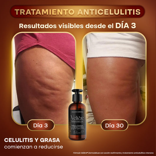 Dermodeluxe Alta Cosmética: Tratamiento para Celulitis, Flacidez, Arrugas y Reafirmante - 250 ML.