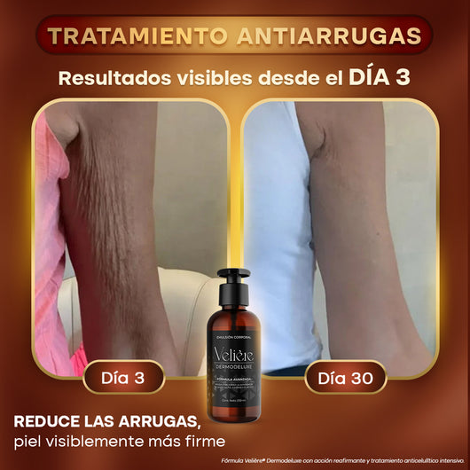 Dermodeluxe Alta Cosmética: Tratamiento para Celulitis, Flacidez, Arrugas y Reafirmante - 250 ML.